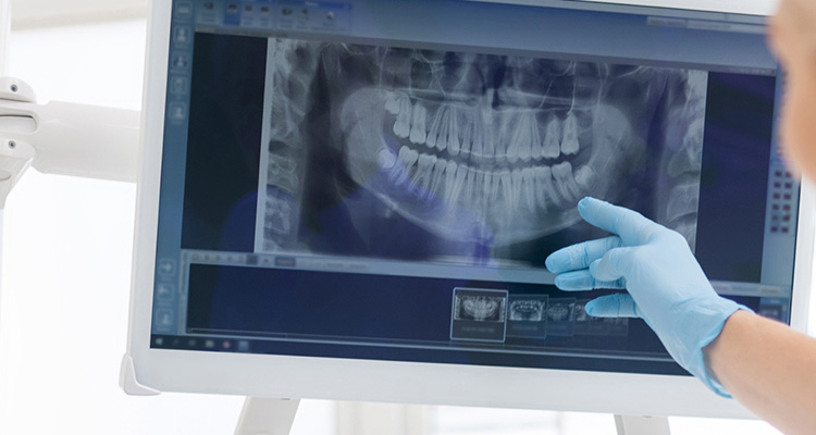 Zahnarzt in Düsseldorf: Zahn-OP beim Fachzahnarzt