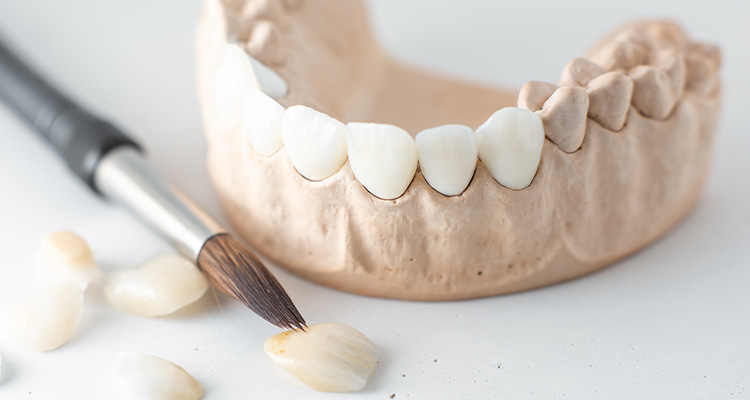 Zahnarzt in Düsseldorf: Zahn-OP beim Fachzahnarzt